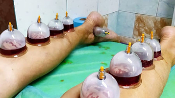 Хиджама центр City hijama