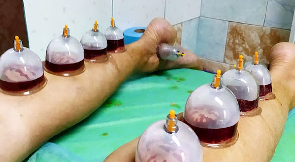 Хиджама центр City hijama